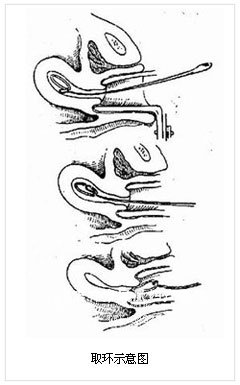 ʹȡϻ